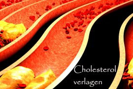 cholesterol verlagen