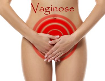 vaginose